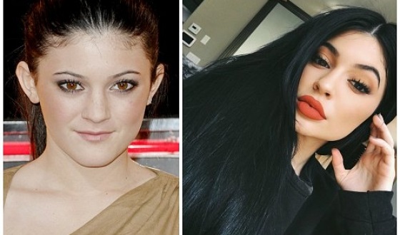 Kylie Jenner avant et après la chirurgie plastique: photos sans maquillage, photoshop, en maillot de bain, enceinte. Quel âge, hauteur, paramètres, biographie