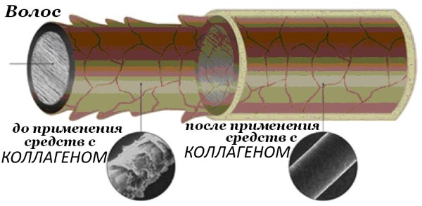 Collagène pour les cheveux. Types, caractéristiques, avantages et inconvénients, conséquences de l'utilisation