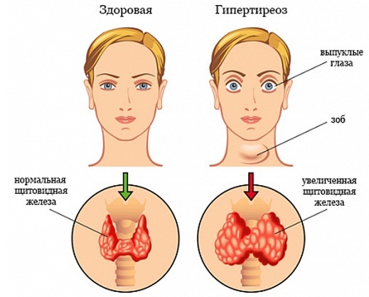 Varech. Propriétés utiles, composition, instructions pour l'utilisation des algues. Recettes pour masques faciaux, minceur, enveloppements, stimulation du travail