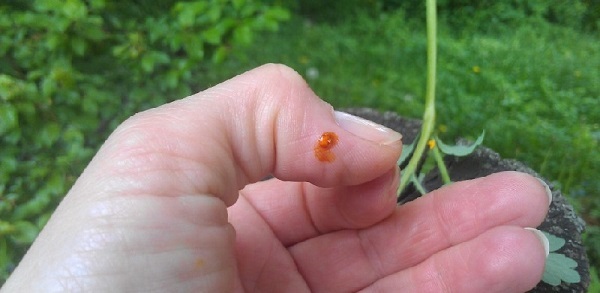 Huile de chélidoine. Propriétés et application pour les maladies cutanées et fongiques, en cosmétologie, gynécologie