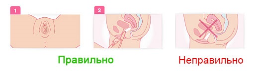 Huile de chélidoine. Propriétés et application pour les maladies cutanées et fongiques, en cosmétologie, gynécologie