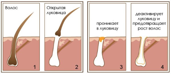 Huile de chélidoine. Propriétés et application pour les maladies cutanées et fongiques, en cosmétologie, gynécologie