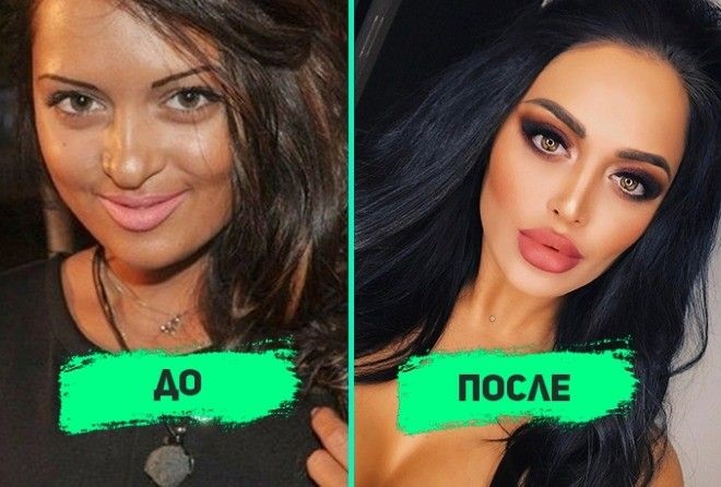 Nita Kuzmina avant et après les plastiques. Photo, quelles opérations la star a faites, biographie