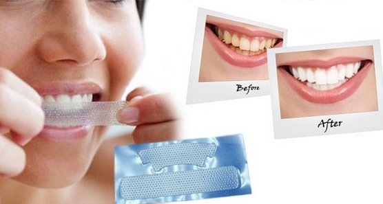 Bandes de blanchiment des dents: blanc 3D, mélangez un Med, Crest, Rigel, Advanced dents, Oral Pro, Bright light. Prix ​​en pharmacie