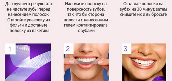 Bandes de blanchiment des dents: blanc 3D, mélangez un Med, Crest, Rigel, Advanced dents, Oral Pro, Bright light. Prix ​​en pharmacie