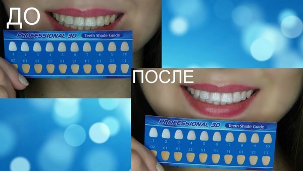 Bandes de blanchiment des dents: blanc 3D, mélangez un Med, Crest, Rigel, Advanced dents, Oral Pro, Bright light. Prix ​​en pharmacie