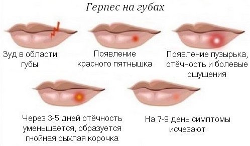 Pommade Stellanin. Instructions d'utilisation, efficacité, avis, analogues