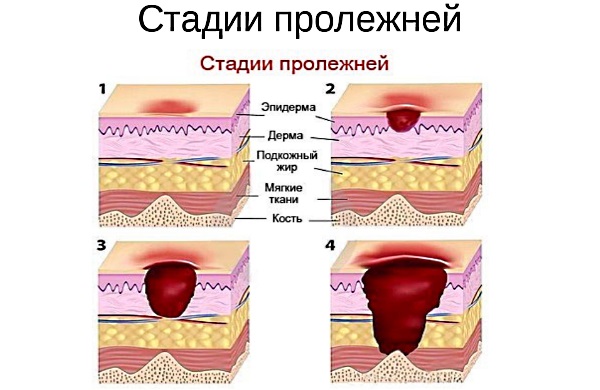 Pommade Stellanin. Instructions d'utilisation, efficacité, avis, analogues