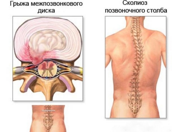 Aspirateur du ventre. Comment faire des exercices correctement, technique pour perdre du poids, gonfler la presse, abdominoplastie après l'accouchement