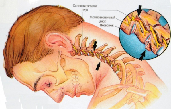 Yoga pour le dos et la colonne vertébrale: caractéristiques, indications et contre-indications, une série d'exercices simples, les meilleures asanas. Vidéo pour les débutants