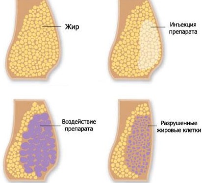 Règles de soins corporels pour une femme à 20, 30, 40, 50 ans. Comment rendre votre corps beau, en forme et mince à tout âge