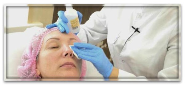 Blépharoplastie non chirurgicale des paupières supérieures et inférieures: circulaire, laser, matériel. Prix, rééducation et complications possibles