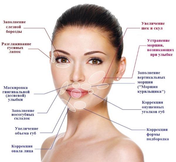 Remplisseurs dans les plis nasogéniens, sous les yeux, dans les lèvres, dans les pommettes. Correction du nez, sillon nasolacrimal. Contour du visage