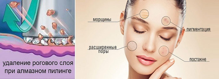 Collagène pour la peau du visage en capsules, comprimés. Avantages, prix en pharmacie, comment prendre du liquide, à l'intérieur, utiliser le sérum