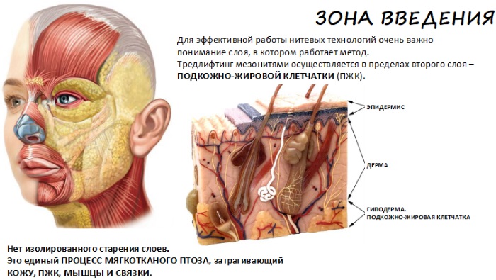 Lifting du visage: qu'est-ce que c'est, SMAS, RF, plasma, massage, ultrasons, filament, endoscopique, ondes radio, vecteur, radiofréquence, laser, acupuncture