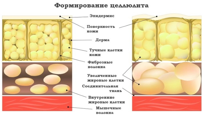 Massage au miel pour la cellulite. Comment le faire correctement pour perdre du poids sur l'abdomen, le dos, les jambes, les fesses à la maison. Cours vidéo