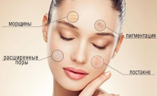 Peeling visage au lait. Meilleur produit chimique glycolique: Arabie, Compliment, Martinex, Gigi, Terre Sainte. Commentaires