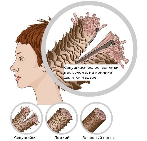 Vitamines Perfectil Trichologic pour les cheveux. Composition, mode d'emploi, indications d'utilisation, analogues, prix