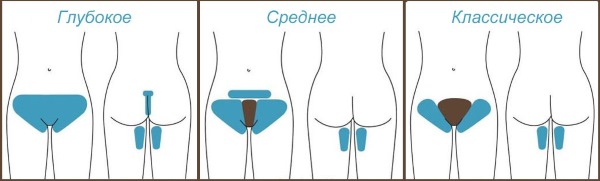 Épilation à la cire ou sucre? Quoi de mieux dans la zone profonde du bikini, les jambes, les aisselles