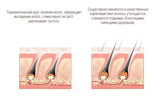 Masques pour la croissance et la chute des cheveux avec Dimexide et vitamines, argousier, huile de bardane. Recettes