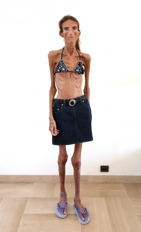 La pire personne au monde est une femme. Filles anorexiques, modèles, célébrités. Une photo