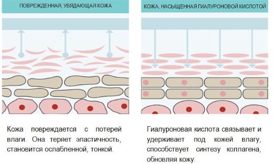 L'acide hyaluronique en cosmétologie. Injections, comprimés, crèmes pour le visage. Avantages, photos avant et après. Revues de médicaments