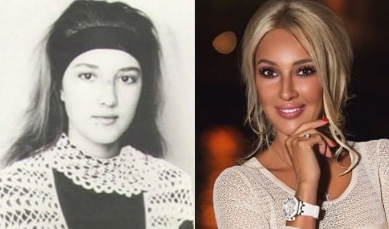 Lera Kudryavtseva. Photos avant et après la chirurgie plastique, chez les jeunes, sans maquillage, âge, paramètres corporels. Comment l'étoile a changé