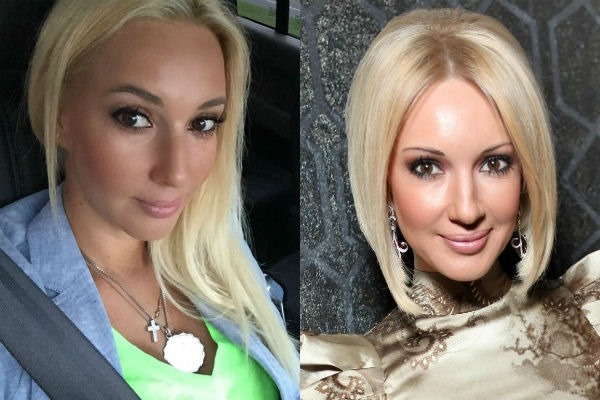 Lera Kudryavtseva. Photos avant et après la chirurgie plastique, chez les jeunes, sans maquillage, âge, paramètres corporels. Comment l'étoile a changé