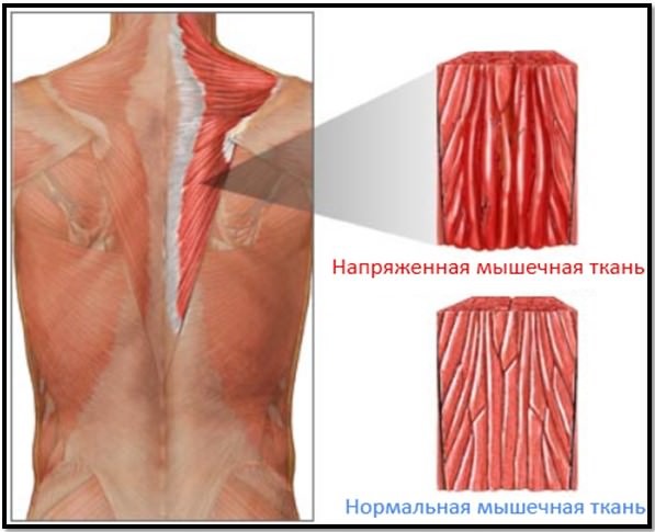 Comment éliminer l'acide lactique dans les muscles du corps après l'entraînement, comment il se forme, comment il affecte, les caractéristiques