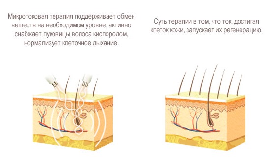 Lifting des seins sans implants. Procédures et méthodes d'élasticité des seins en cosmétologie