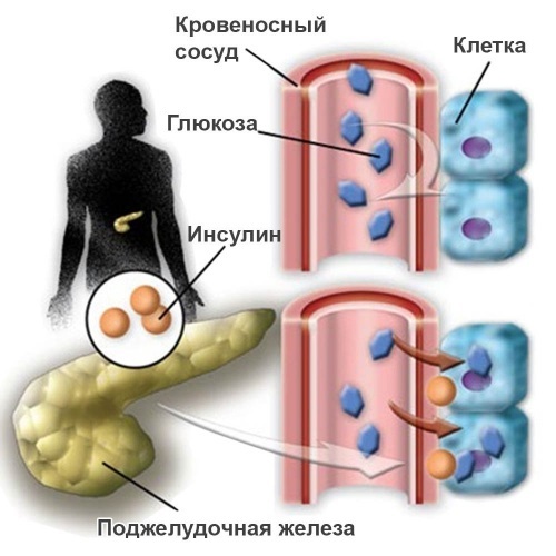 Massage de drainage lymphatique des jambes, des cuisses, de l'abdomen avec lymphostase, varices, œdème, varices, grossesse. Technique comment le faire vous-même