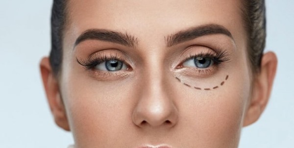 Blépharoplastie. Avis des opérés. Avantages et inconvénients de la chirurgie plastique, complications, rééducation. Laser, transconjonctival, circulaire, injection