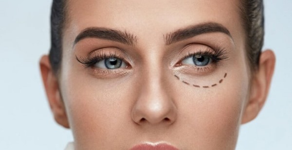 Blépharoplastie au laser. Examens des paupières inférieures et supérieures opérées, comment ils le font. Des prix