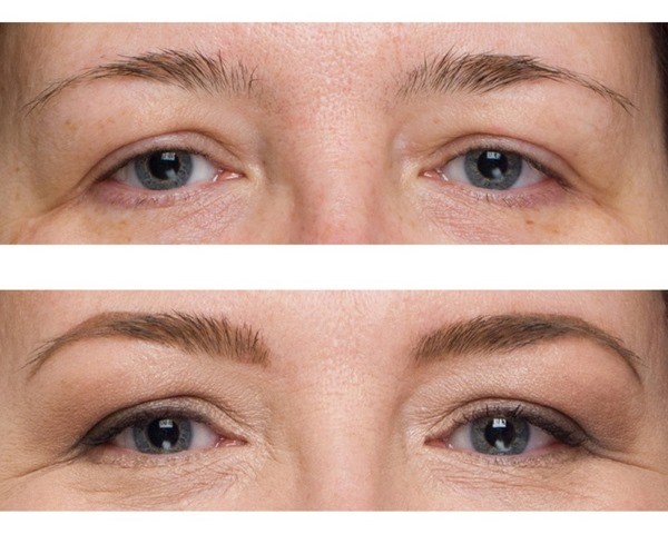 Acide nicotinique pour sourcils et cils en ampoules. Application, comment utiliser, photos, avis