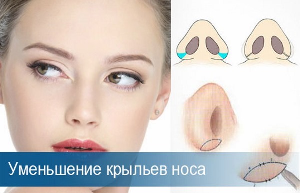 Rhinoplastie à Moscou. Prix ​​et avis des cliniques dans la capitale