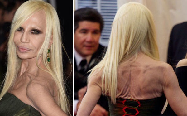 Donatella Versace avant et après la chirurgie plastique. Photo, taille, poids, biographie, âge