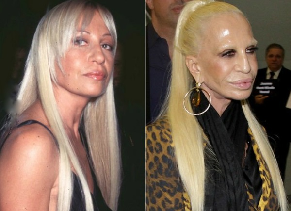 Donatella Versace avant et après la chirurgie plastique. Photo, taille, poids, biographie, âge