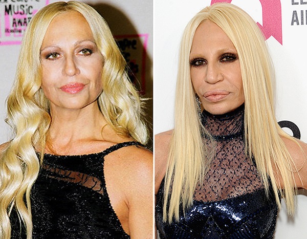 Donatella Versace avant et après la chirurgie plastique. Photo, taille, poids, biographie, âge