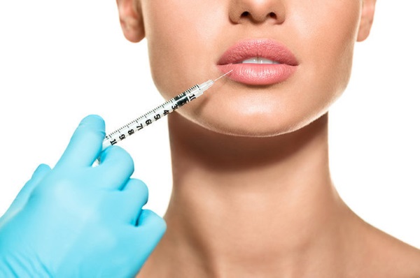 Comment agrandir les lèvres avec de l'acide hyaluronique, du botox, du silicone, du lipofilling, de la cheiloplastie. Photos, prix, avis