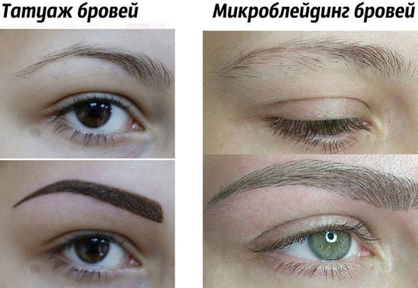 Microblading des sourcils. Photos avant et après, qu'est-ce que c'est, combien de temps ça dure, comment ça se fait, le prix