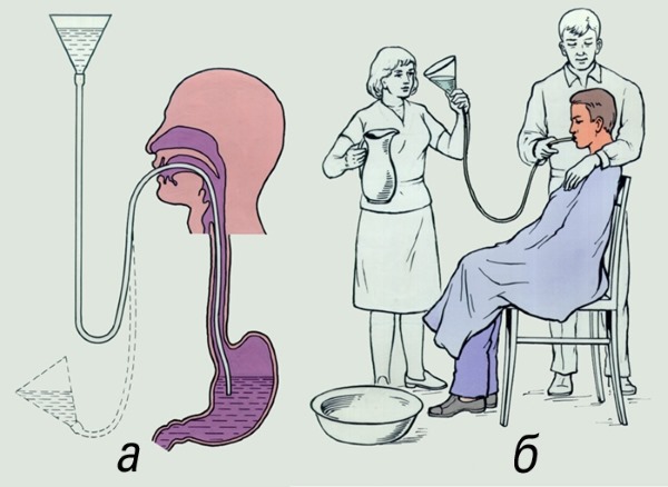 Comment enlever un gros ventre chez les femmes et les hommes. Causes et remèdes