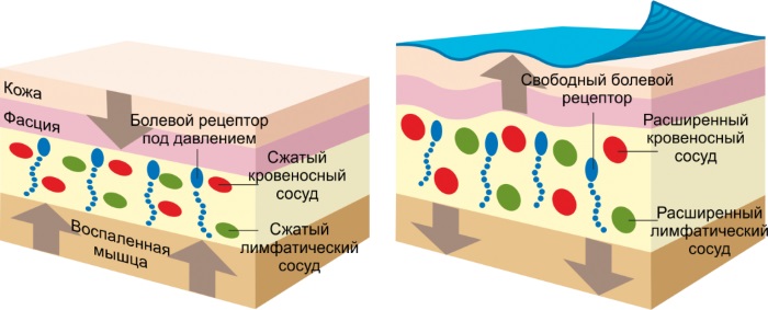 Bande Kinesio. Qu'est-ce que c'est en cosmétologie, médecine, sport. Rubans, esthétique, drainage lymphatique des rides, des plis nasogéniens