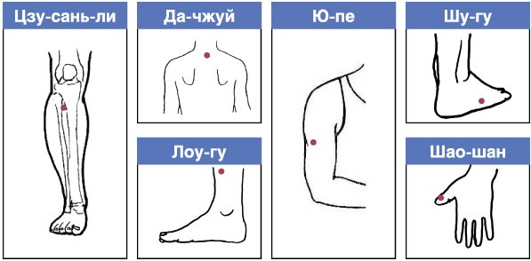 Points sur le corps pour amincir l'abdomen, les côtés, les hanches. Acupuncture du corps humain, diagramme, photo, vidéo