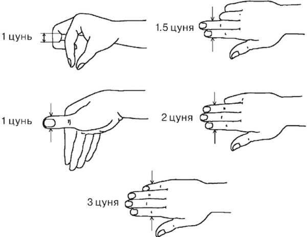 Points sur le corps pour amincir l'abdomen, les côtés, les hanches. Acupuncture du corps humain, diagramme, photo, vidéo