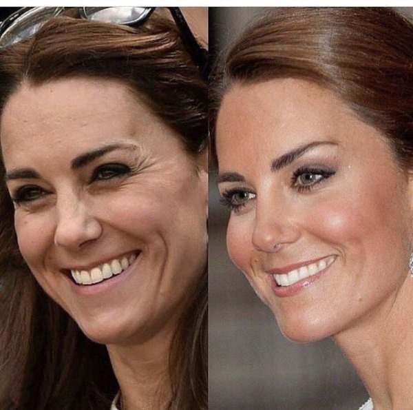 Kate Middleton. Des photos de ma jeunesse, maintenant, avant et après la chirurgie plastique, sur la plage, franche. Biographie et vie personnelle