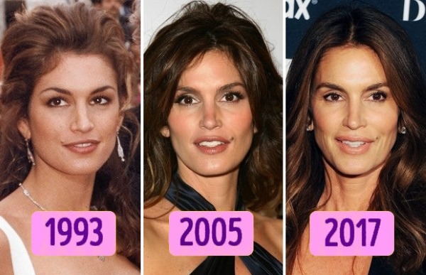 Cindy Crawford. Photos maintenant, chez les jeunes, changements avant et après la chirurgie plastique