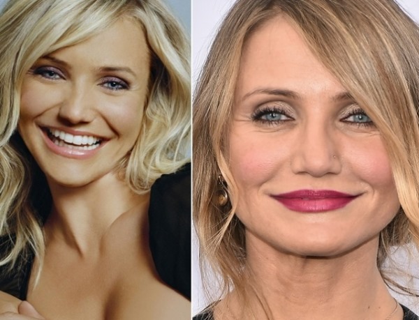 Actrices hollywoodiennes. Photos avec des noms, les plus belles blondes, brunes, rousses. Qu'est-ce que la chirurgie plastique a fait