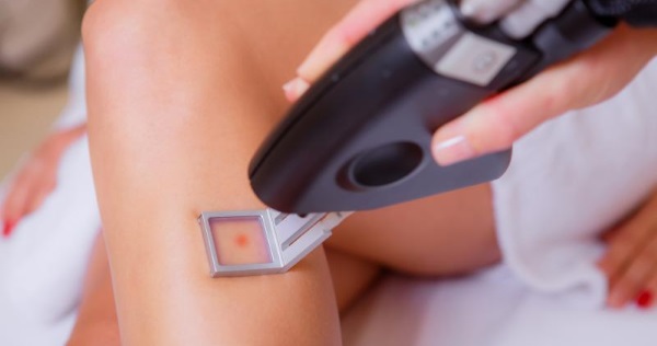 Epilator laser terbaik untuk kegunaan rumah. Penilaian profesional, ulasan