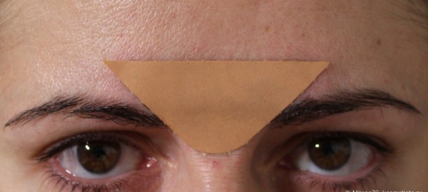 Comment enlever une ride entre les sourcils. Plâtre, onguents, crèmes, exercices, massage, botox