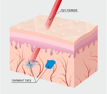 Maquillage permanent de l'espace entre les cils. Photo, combien de temps, prix, comment